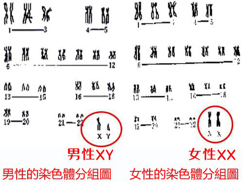 胎儿染色体疾病,胎儿染色体遗传病