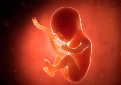 胎儿畸形,胎儿染色体变异,产检