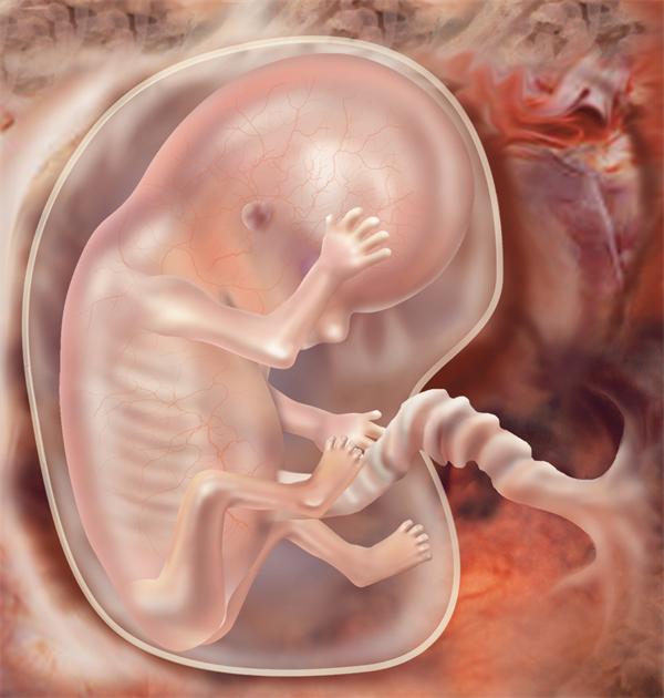 叶酸,胎儿畸形,孕妇